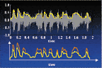 Interacoustics