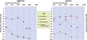 Fitting Automatic Directional Hearing Instruments