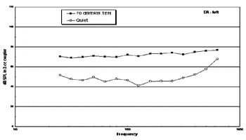 Cochlear Dead Regions and Practical Implications for High Frequency Amplification