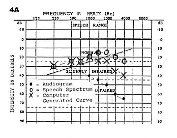 Marketing Hearing Rehabilitation The Hearing Review A Medqor Brand