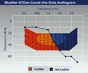 Wireless Technology in an Open-Ear Solution