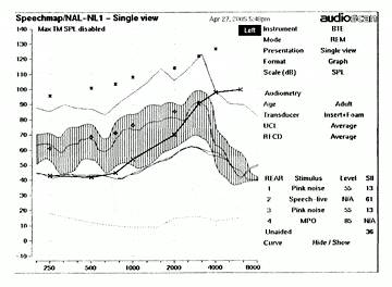 SchollChart_LiveVoice.gif (21493 bytes)