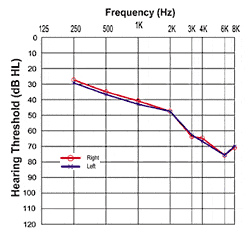 Clinical Study of a New Directional System: Initial Behavioral Results