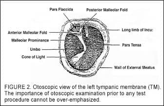 normal tympanic membrane labeled