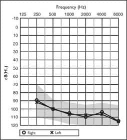 Upgrading Children to Super-power MCNL Aids: A Clinical Trial Using an A-B-A Test Method