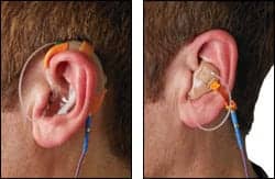 Hearing aid configurations