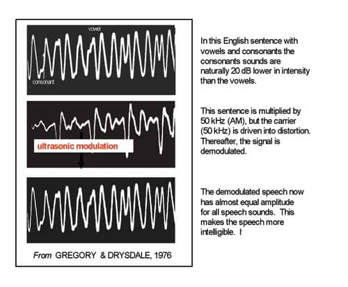 High-Frequency Stimulation in Sensorineural Hearing Loss