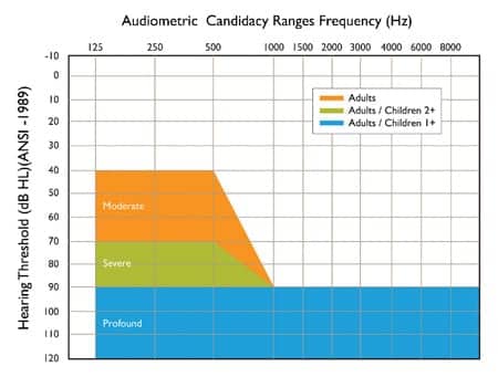 Identifying Cochlear Implant Candidates In The Hearing Aid Dispensing ...