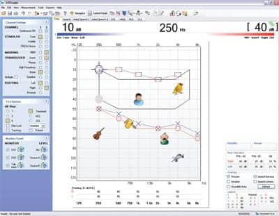 Maximizing the Patient Counseling Experience with PC-based Audiometry