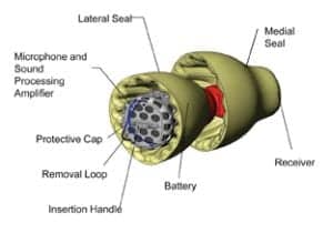 Real-World Safety Experience with a 24/7 Hearing Device