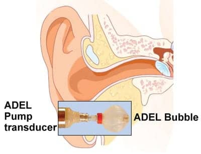 A Voice-activated, Inflatable, Self-regulating Balloon Ear Coupler