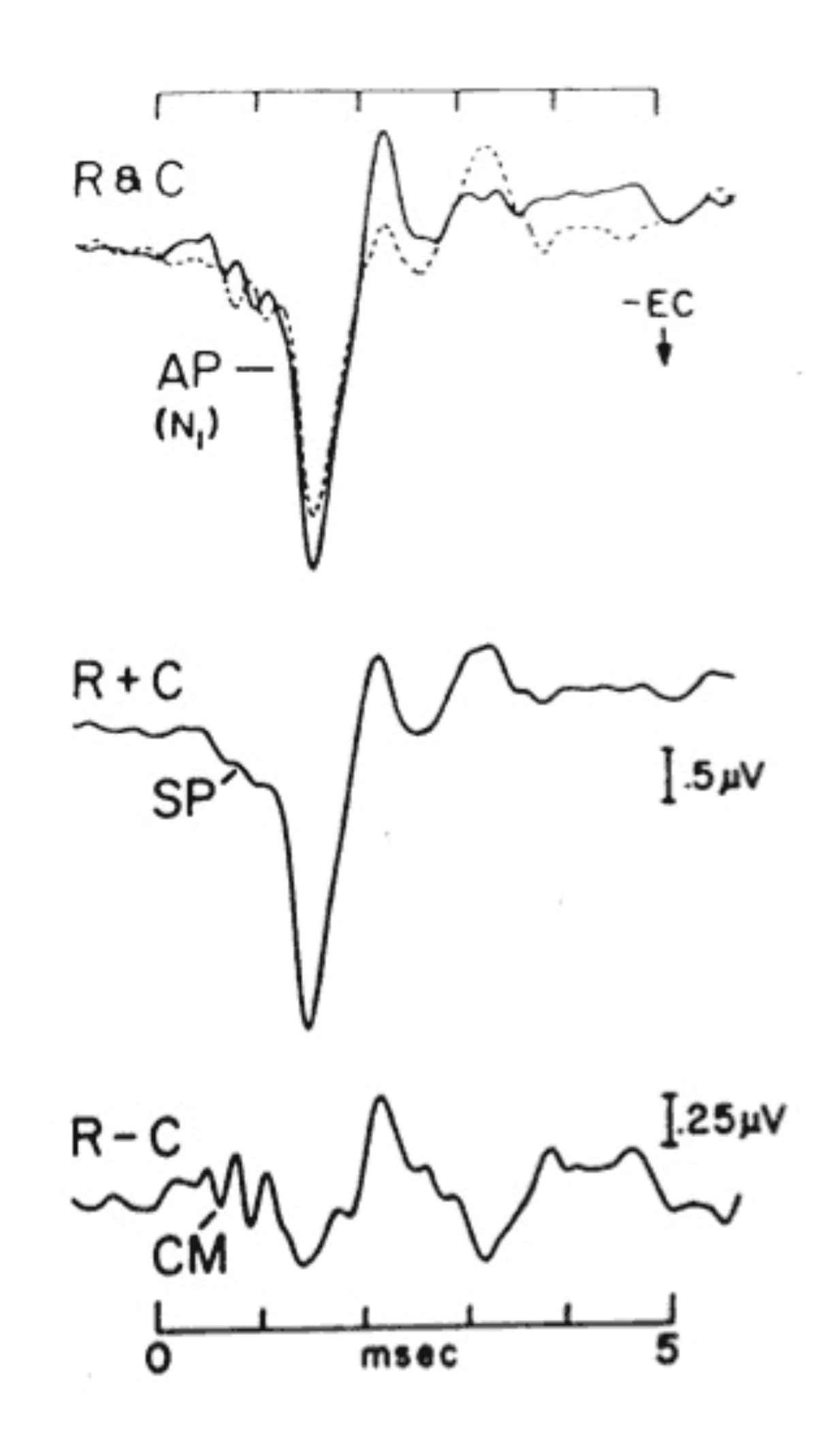 Examination and Comparison of Electrically Evoked Compound Action