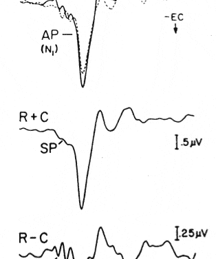 Developments in Electrocochleography: 2011