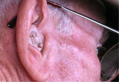 University of Cambridge Develops Software to Improve Hearing Aid Sound Quality