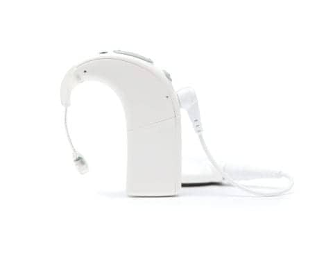 Advanced Bionics Partners with Phonak for the New Naída CI Q70 Sound Processor
