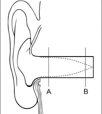 The Acoustics of Hearing Aids: Standing Waves, Damping, and Flared Tubes