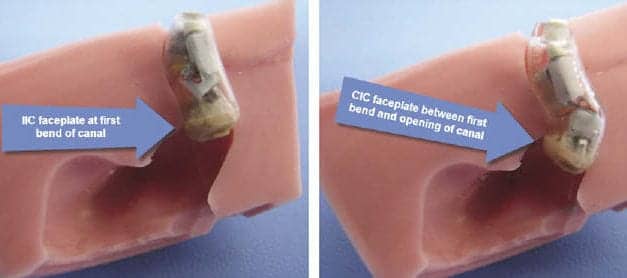 Thinking Outside the Casing: Ultra-cosmetic Hearing Aids