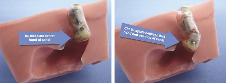 Thinking Outside the Casing: Ultra-cosmetic Hearing Aids