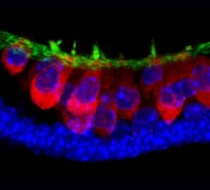 Indiana University Researchers Create Inner Ear Structures from Stem Cells