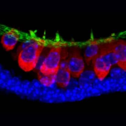 Indiana University Researchers Create Inner Ear Structures from Stem Cells