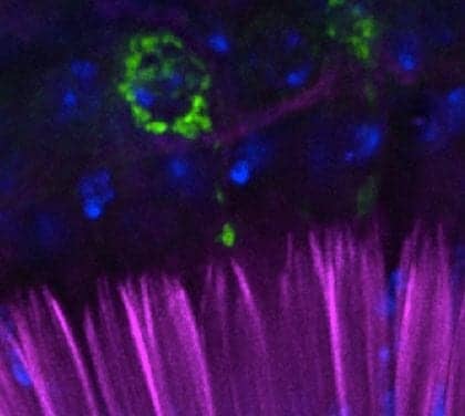 Study Shows Fruit Fly Is Ideal Model to Study Hearing Loss in People