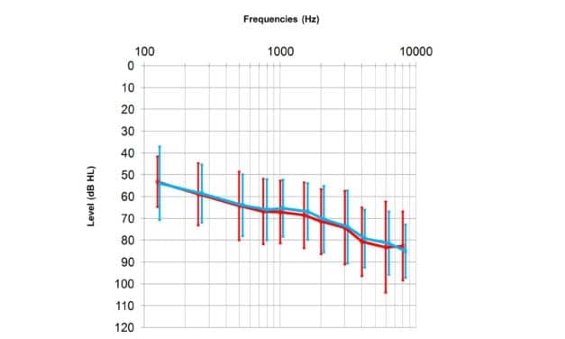 Comparison of Different Directional Microphone Technologies for Moderate-to-Severe Hearing Loss
