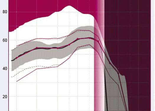 10 Questions About Frequency Compression