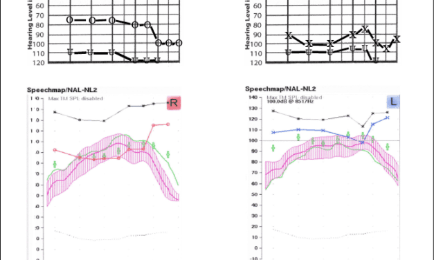 A Time-efficient Method and Form for Documenting Hearing Aid Benefit