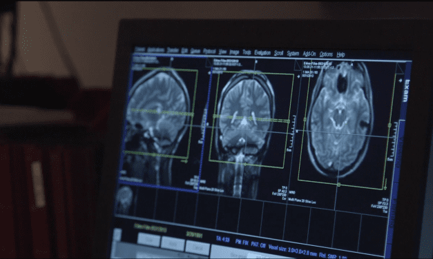 Brain Differences Between Deaf and Hearing People Depend on First Language Learned