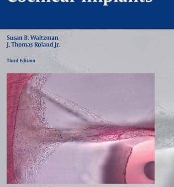 New Cochlear Implant Publication