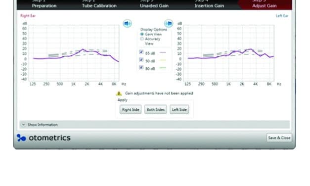 Fast and Easy Fitting and Verification with Integrated Real-ear Measurement