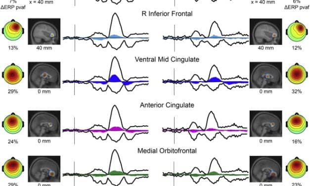 EEG Tests May Help Retrain Schizophrenia Patients’ Auditory Brain Circuits