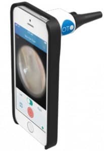 CellScope Oto PRO Smartphone-enabled digital otoscope