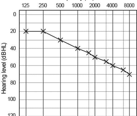 Proprietary Hearing Aid Gain Prescriptions: Changes Over Time