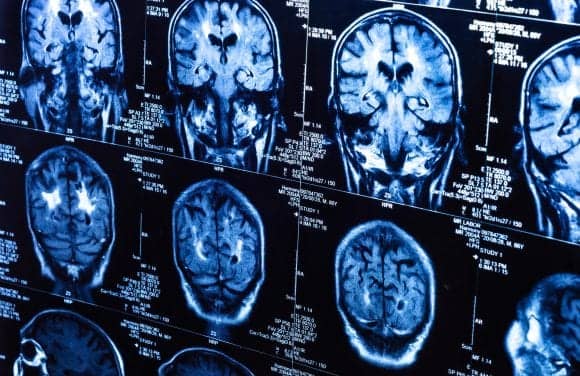 Brain Scan Study Explores Emotional Responses to Room Acoustics