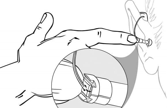Hearing Aid ‘Buttons’ Help Users Control In-canal Receivers