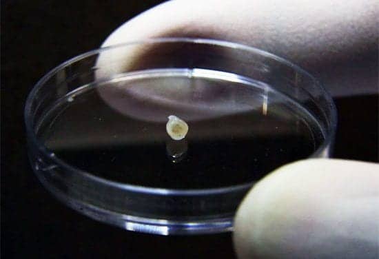 Scientists Grow ‘Mini-brains’ to Study Parkinson’s and Other Diseases