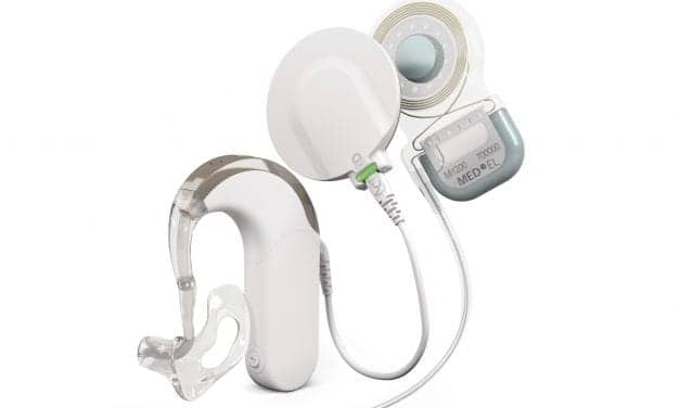 Electric Acoustic Stimulation Hearing Implant Gains FDA Approval