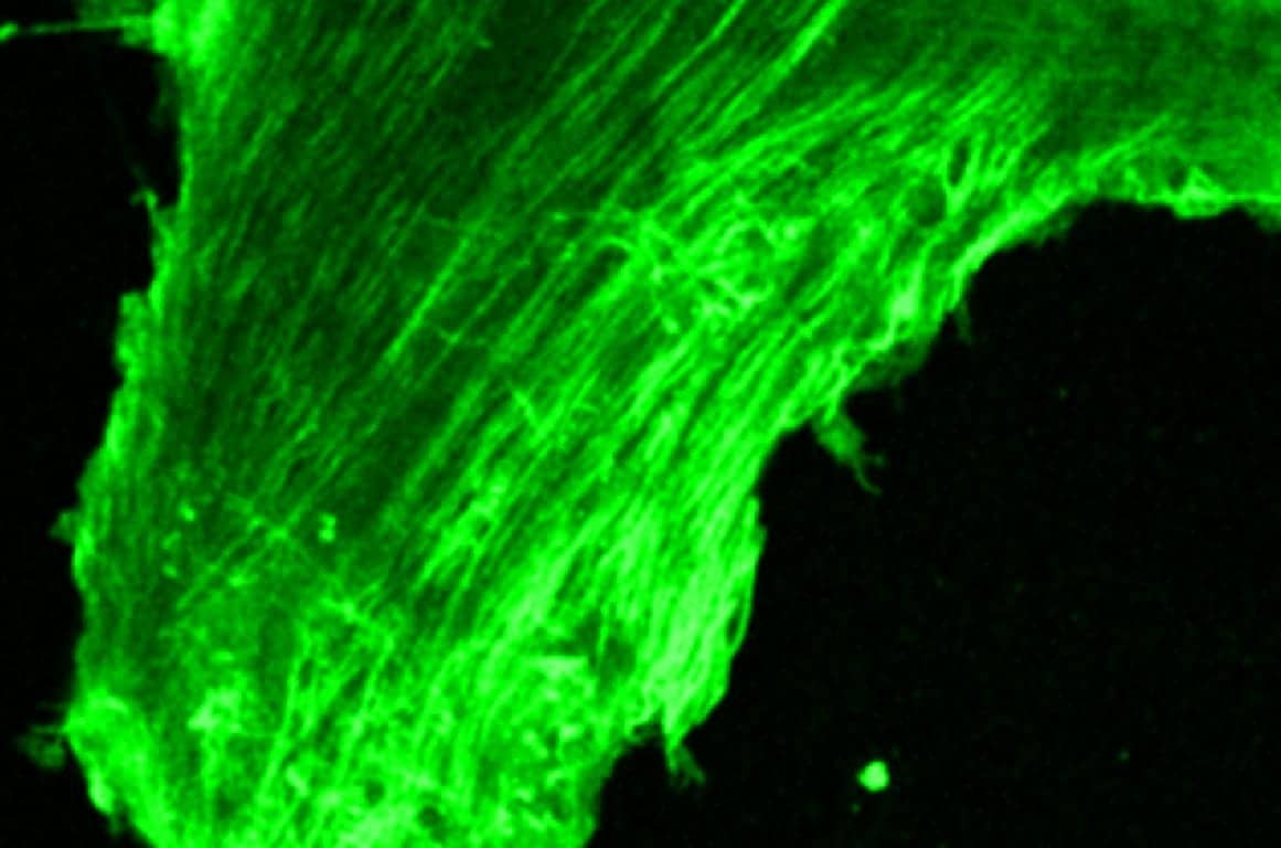 Hearing Loss Can Change How Nerve Cells Are Wired