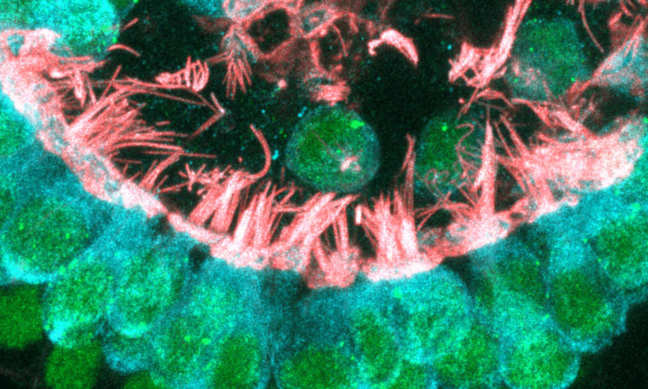 Study Shows Hair Cell Regrowth with New Drug