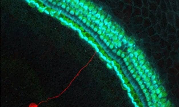 Chromatin May Regulate Uncontrolled Stem Cell Proliferation During Auditory Neuron Conversion