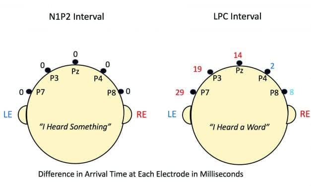 The Remarkable History of Right-Ear Advantage