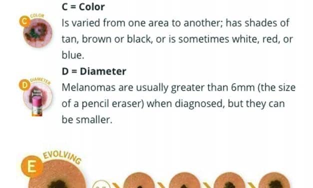 A Skin Cancer Screening Model for Hearing Care Professionals