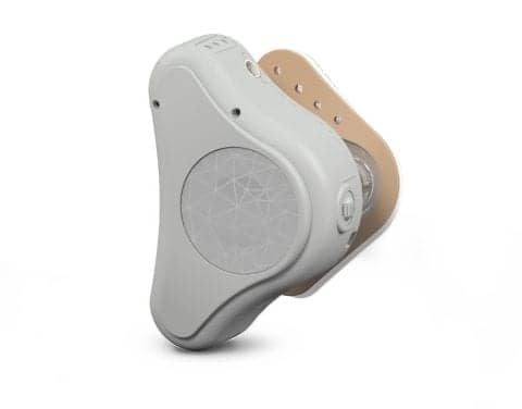 ADHEAR Adhesive Adapter System for Conductive Hearing Loss Cleared by FDA