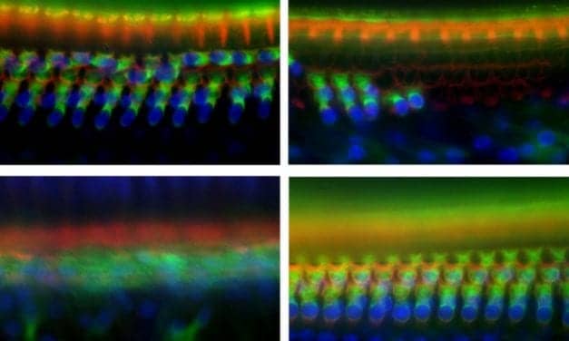 UCSF Researchers Find Gene Related to Noise-induced Deafness