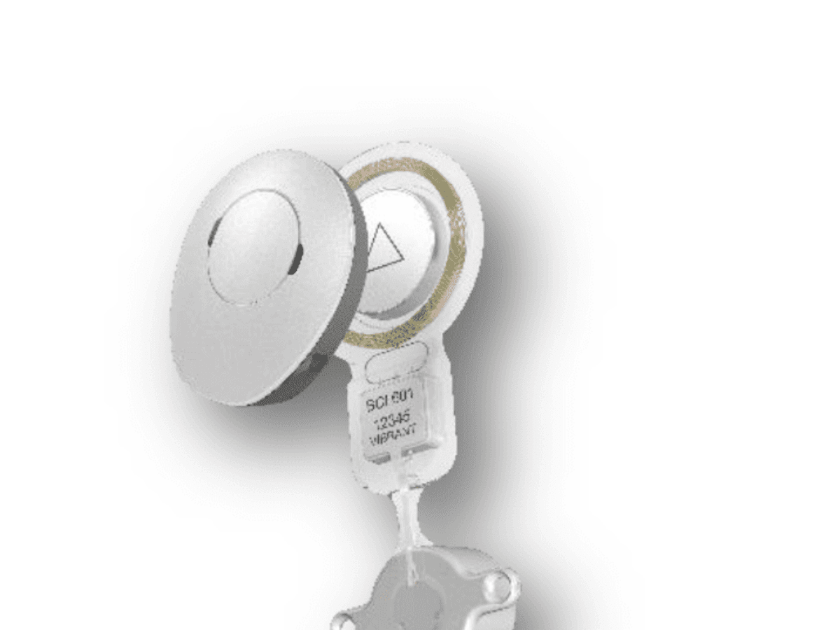 Oral implantology: Basics, ITI hollow cylinder system