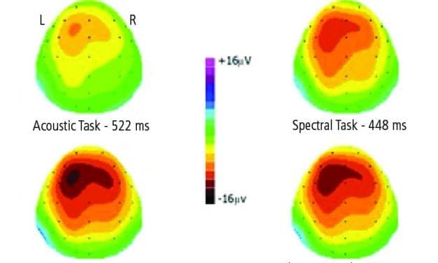 AERPs Reflect Complexity of Word Recognition