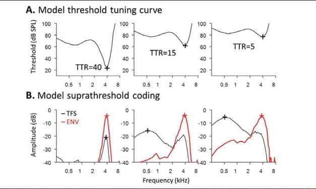 Noise and Age Affect Sound Processing Differently, Study Finds