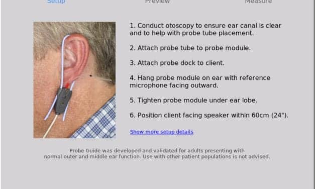 Evaluation Of Probe Guide: Software-assisted Probe Tube Placement In Hearing Aid Fittings