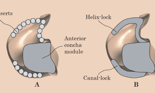 A New Solution for Automated 3D Virtual Modeling of Custom Hearing Aid Shells